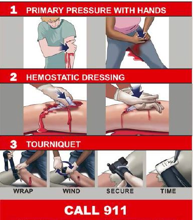 First-Aid Tips Could Save a Life After a Shooting or Accident