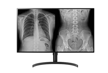 LG 32” 8MP IPS Medical Diagnostic Review Monitor