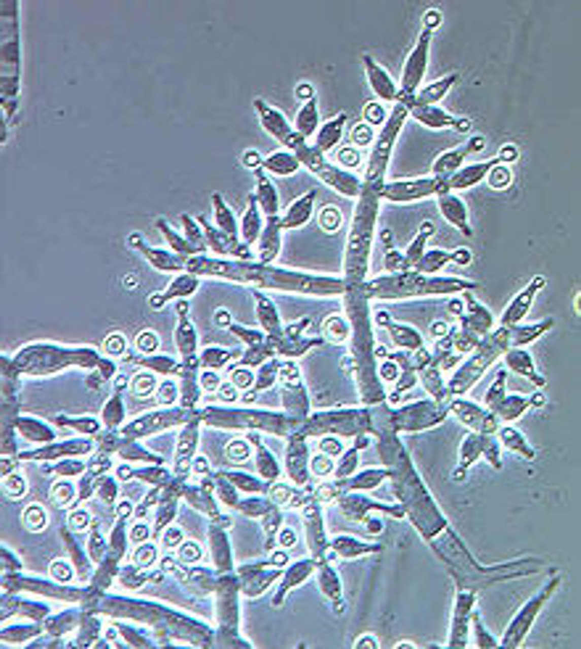 Remidi TB Trichoderma & B.Sub