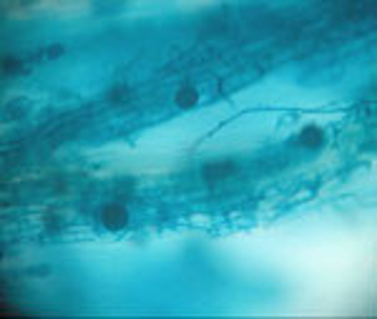 Mycorrhizal Fungi