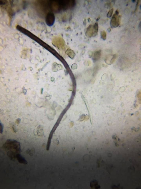 Visual Soil Life Assessment