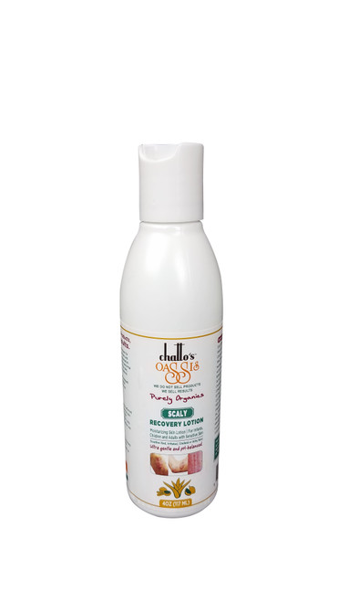 
 We blend ingredients well-known for centuries to soothe broken, irritated skin and support healthy skin cell rejuvenation. This product helps reduce the abnormal and recurring condition of the skin as well as inflammation and flakiness. 

This nutrient rich cream with vitamin A, antioxidants, and essential oils moisturizes dry-flaky skin, scaly skin and clears serious skin problems. The versatile active ingredients such as Oatmeal, Shea Butter, and organic oils and herbs help moisturizing and rejuvenation. The product is non-greasy, gentle, highly effective and suitable for Infants and children.

Nothing comes close to the ancient healing properties of Chatto's unsurpassed products.




- Hypoallergenic - Biodegradable - No Animal Products - No Petroleum - No Alcohol - No Paraben - No Synthetic Fragrances [Perfumes] - No Formaldehyde -
No Harsh Chemicals, No Parabens, No Synthetic ,No  Alcohol ,NO  Dyes or Petroleum  