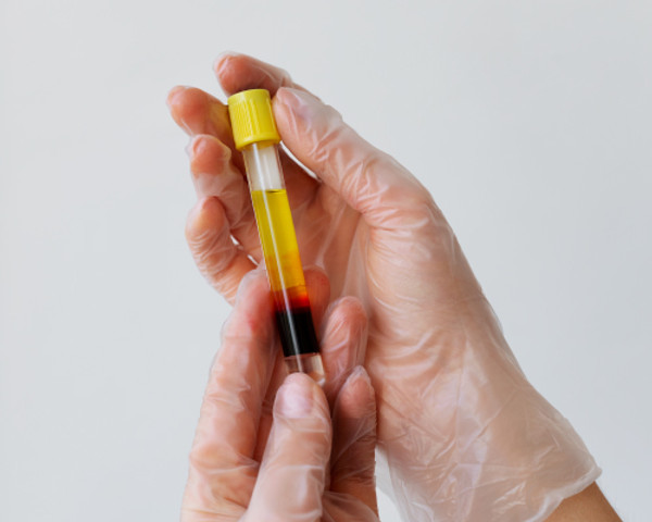 Proteína C Reactiva Cualitativa