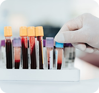 Tecnología de Avanzada