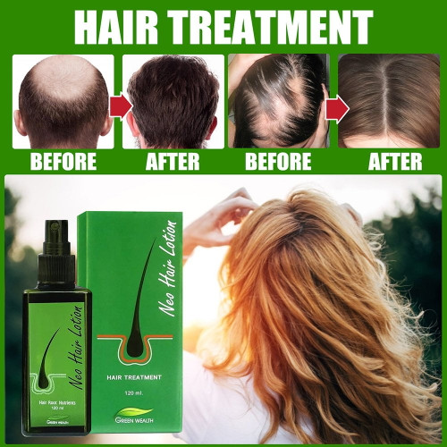 Hair Lotion Spray Grow Hair And Nourish Hair Roots Hair Regrowth For Thinning Hair Hair Growth