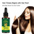 7 Days Ginger Germinal Hair Growth Serum Hairdressing Oil Hair Dry/damaged/loss Treatment