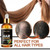 Elecsop Hair Growth Oil, Biotin Hair Growth Serum Hair Loss Treatment For Promotes Hair Regrowth, Prevent Thinning Hair