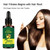 Jandel 1 Pack Ginger Germinal Oil,2021 Hair Growth Ginger Essential Oil Hair Growth Oil Hair Loss Treatment For Women And Men
