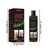 Tihlmk Anti-itch Shampoo For Tinea Capitis To Remove Dandruff And Relieve Itchy Scalp