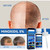 Minoxidil 5% Liquid Extra Strong For Men Beard Hair Regrowth Solution Treatment