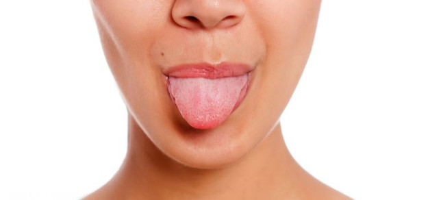 Callus on Tongue