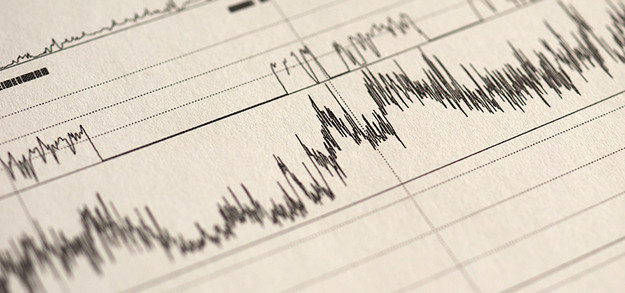 Sleep Study for Bruxism