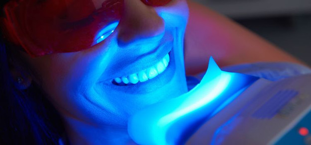 Can I Wear My Night Guard After Teeth Whitening?