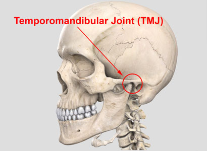 Mouth Guard for TMJ and Bruxism - Pro Teeth Guard