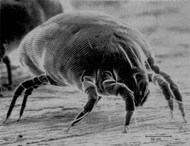 Keep Dust Mites and Allergies Under Control | Vapor Clean