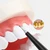 2407 NEW Dental calculus remover with three levels of adjustment, portable electric ultrasonic dental cleaner for home use  8902