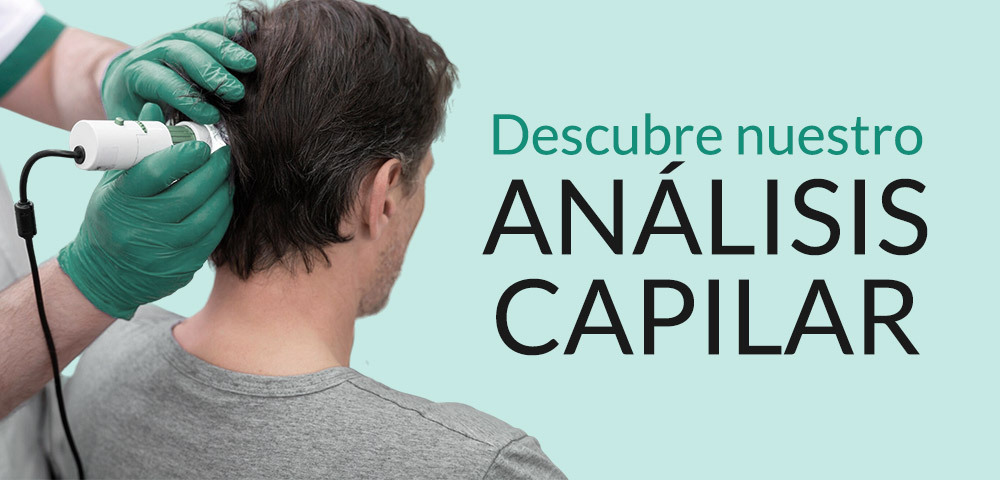 Análisis capilar en Farmacia Pontes en Usera, Madrid