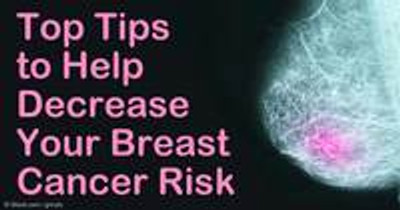 Top 5 articles on Natural Breast Cancer Prevention