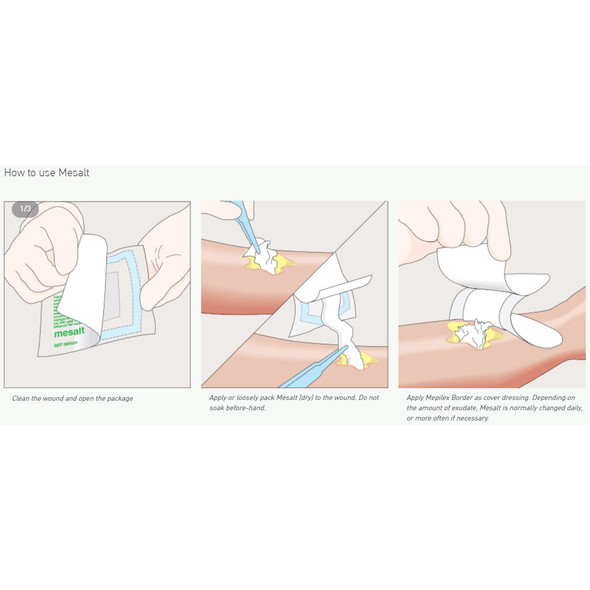 Mesalt® Impregnated Dressing, 2 x 2 Inch