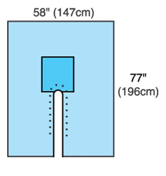 Cardinal Health Sterile Split Orthopedic Drape, 77 W x 120 L Inch