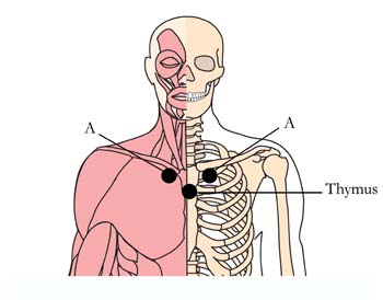 os-14-hay-fever-allergy-cell-points1.jpg