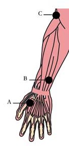 os-14-hay-fever-allergy-cell-points3b.jpg