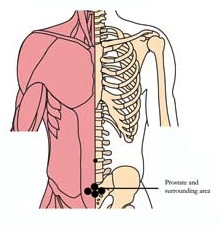 os-24-prostate-tlc-points.jpg