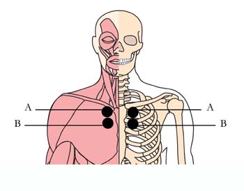 os-8-bronchial-asthma-cell-points.jpg