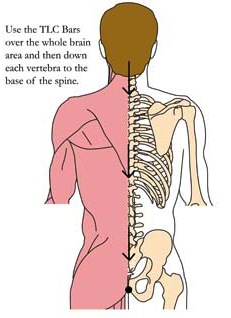 os-bra-brain-celebral-tlc-points.jpg