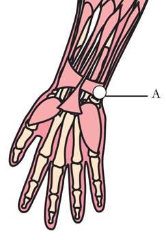 os-hrt-heart-cell-points.jpg