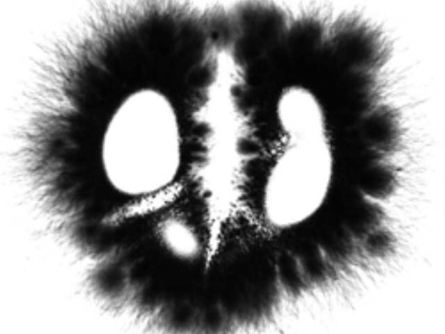 Peach2 Kirlian Study Tachyon