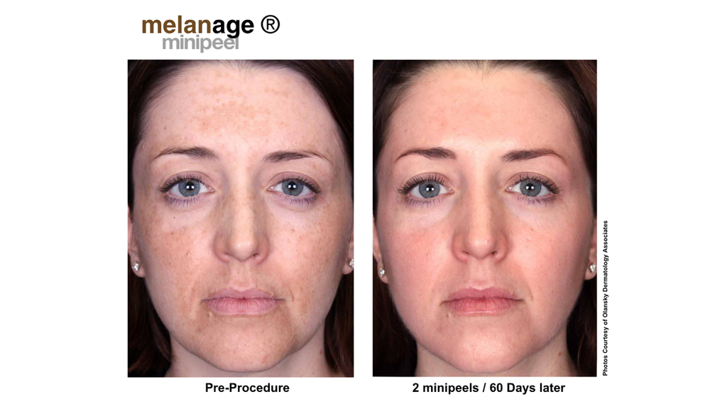 Ultimate Glow Package