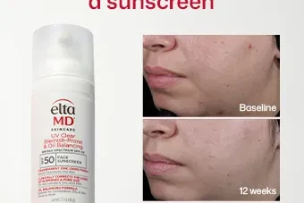 EltaMD UV Clear Blemish-Prone & Oil Balancing