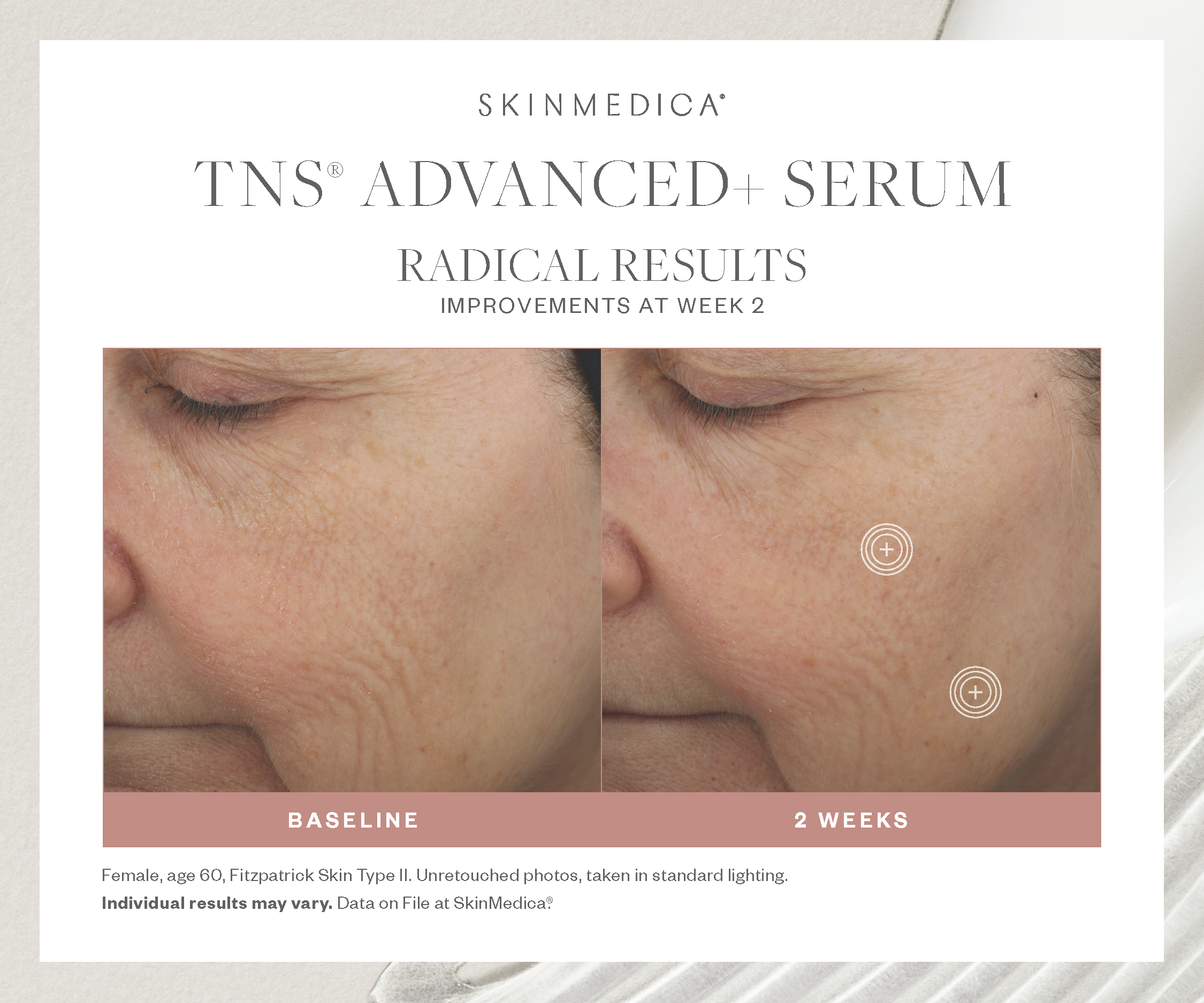 tns advanced serum