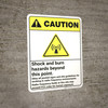 Caution: Shock And Burn Hazard ANSI - Wall Sign Caution: Shock And Burn Hazard ANSI - Wall Sign