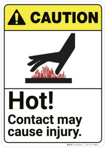 Caution: Hot Contact May Cause Injury ANSI - Wall Sign