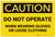 Caution: PPE Do Not Operate When Wearing Gloves or Loose Clothing - Label