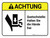 Achtung - Quetschstelle Halten Sie die Hände frei (Caution - Pinch Point Keep Hands Clear) ANSI German - Wall Sign