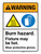 Warning: Burn Hazard Fixture May Be Hot Wear Protective Gloves Portrait - Wall Sign