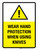 Wear Hand Protection When Using Knives Portrait - Wall Sign