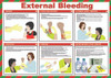 External Bleeding safety poster