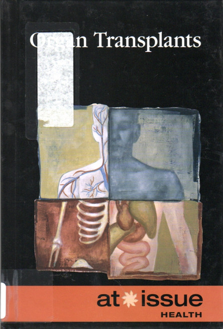 Organ Transplants (At Issue) front cover by Diane Andrews Henningfeld, ISBN: 0737755865