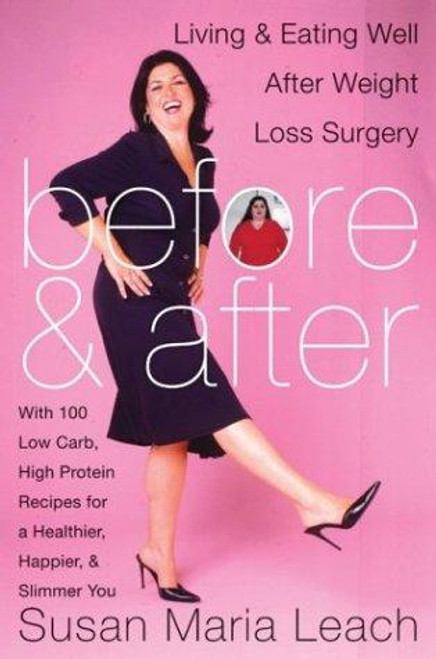 Before and After: Living and Eating Well After Weight Loss Surgery front cover by Susan Maria Leach, ISBN: 0060567228