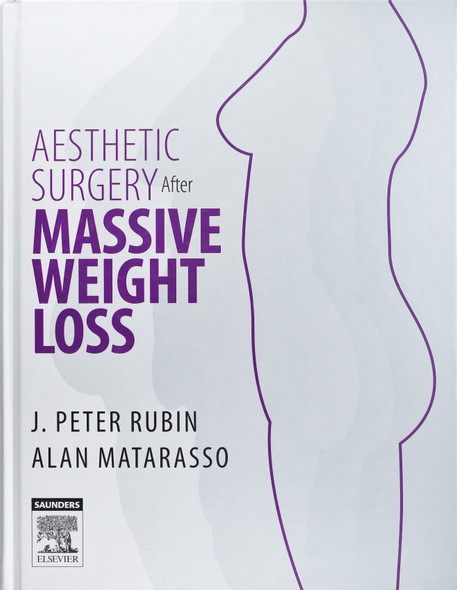Aesthetic Surgery After Massive Weight Loss, 1e front cover by J. Peter Rubin and Alan Matarasso, ISBN: 1416029524