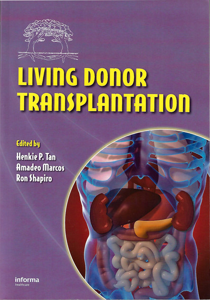 Living Donor Organ Transplantation(softcover Edition for Special Sale) front cover by Henkie P. Tan, ISBN: 1420085565