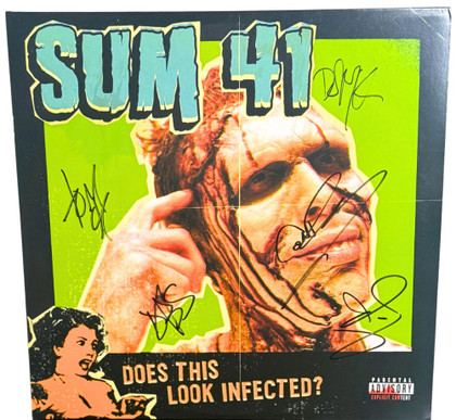 Does This Look Infected Vinyl (Green & Blue Vinyl)