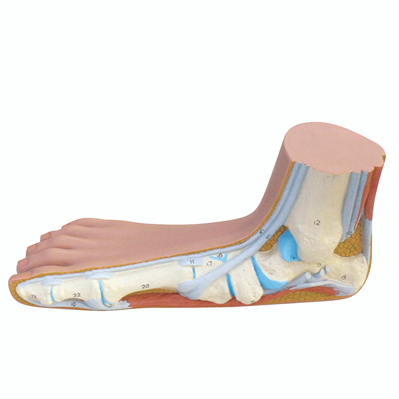 Anatomical Foot Model, Flat Foot, Pes Planus, 3B Smart Anatomy Included