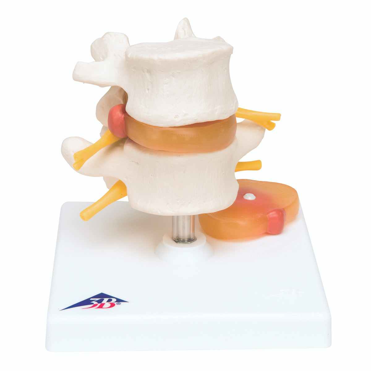 Lumbar_2-