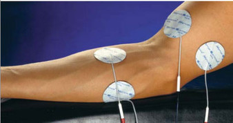 EZ-Trode 2-inch Round Self-Adhesive Electrodes for Interferential Stimulation - Pack of 40