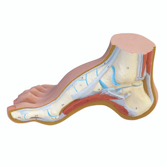 Anatomical Foot Model, High Arch, Pes Cavus, Hollow Foot, with 3B Smart Anatomy